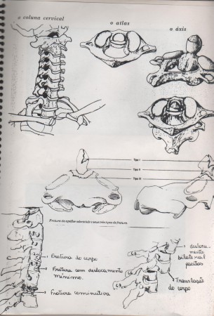 TRM-traumatismo raquimedular alto